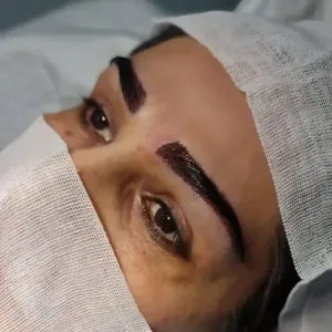 کاشت-مو-و-ابرو-11