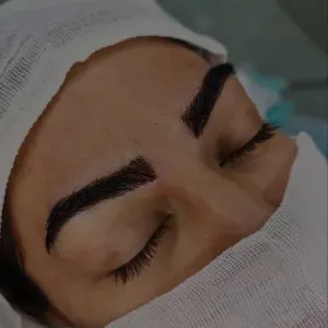 کاشت-مو-و-ابرو-7