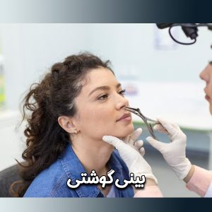 عمل بینی گوشتی در رفسنجان _ دکتر محسن ابویی