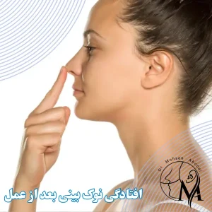 درمان افتادگی نوک بینی بعد از جراحی _ دکتر محسن ابویی