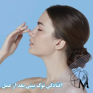 درمان افتادگی نوک بینی بعد از عمل - دکتر محسن ابویی