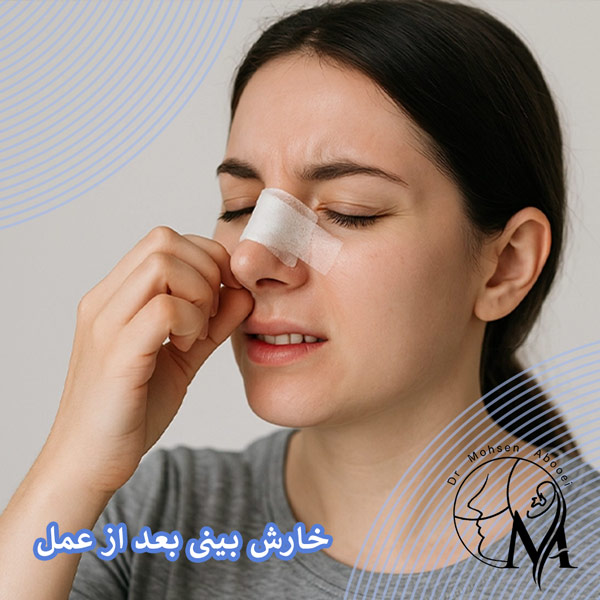 خارش بینی بعد از عمل _ دکتر محسن ابوی