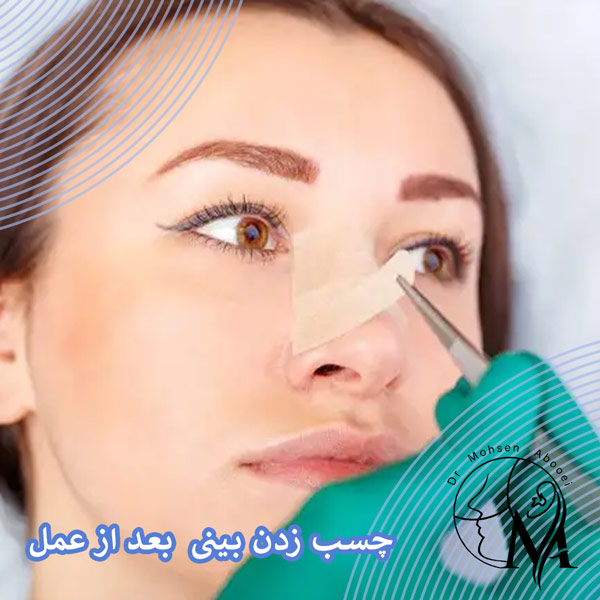 چسب زدن بینی بعد از عمل _ دکتر محسن ابویی