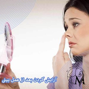 آرایش کردن بعد از عمل بینی _ دکتر محسن ابویی