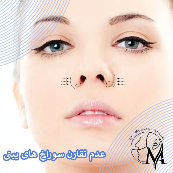 عدم تقارن سوراخ های بینی _ دکتر محسن ابویی
